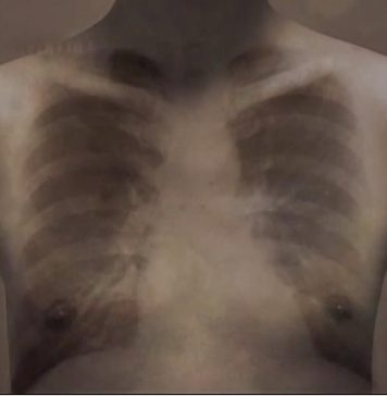 Acervo Comentado VB: Liu Wei por Márcio Seligmann-Silva Cena do filme SARS (2003), de Liu Wei. Foto: Cortesia Videobrasil.